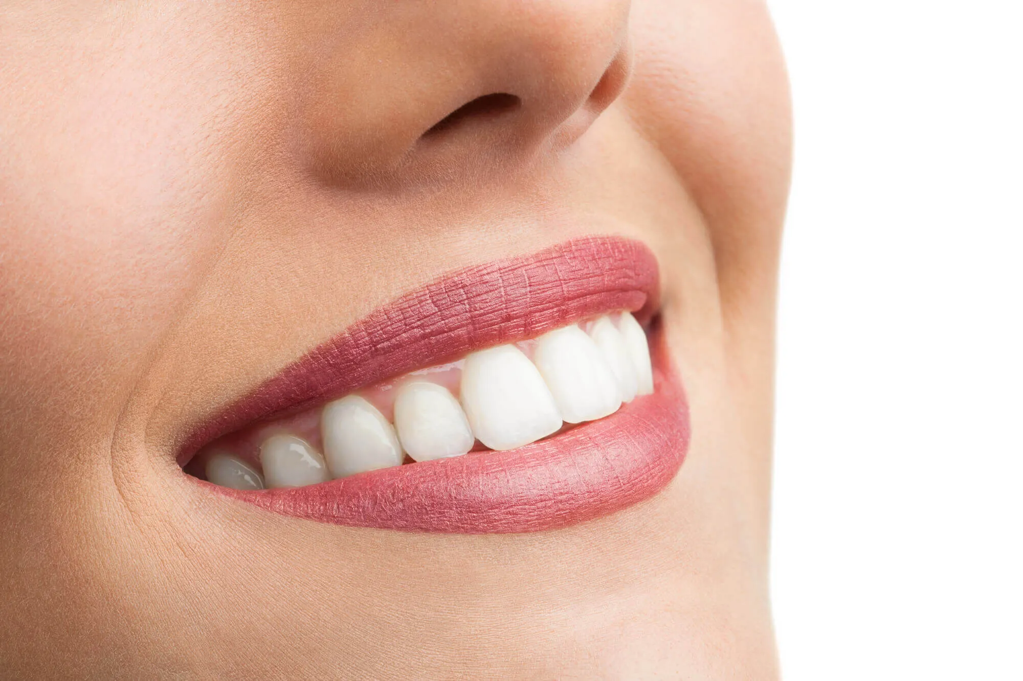 woman after tooth bonding