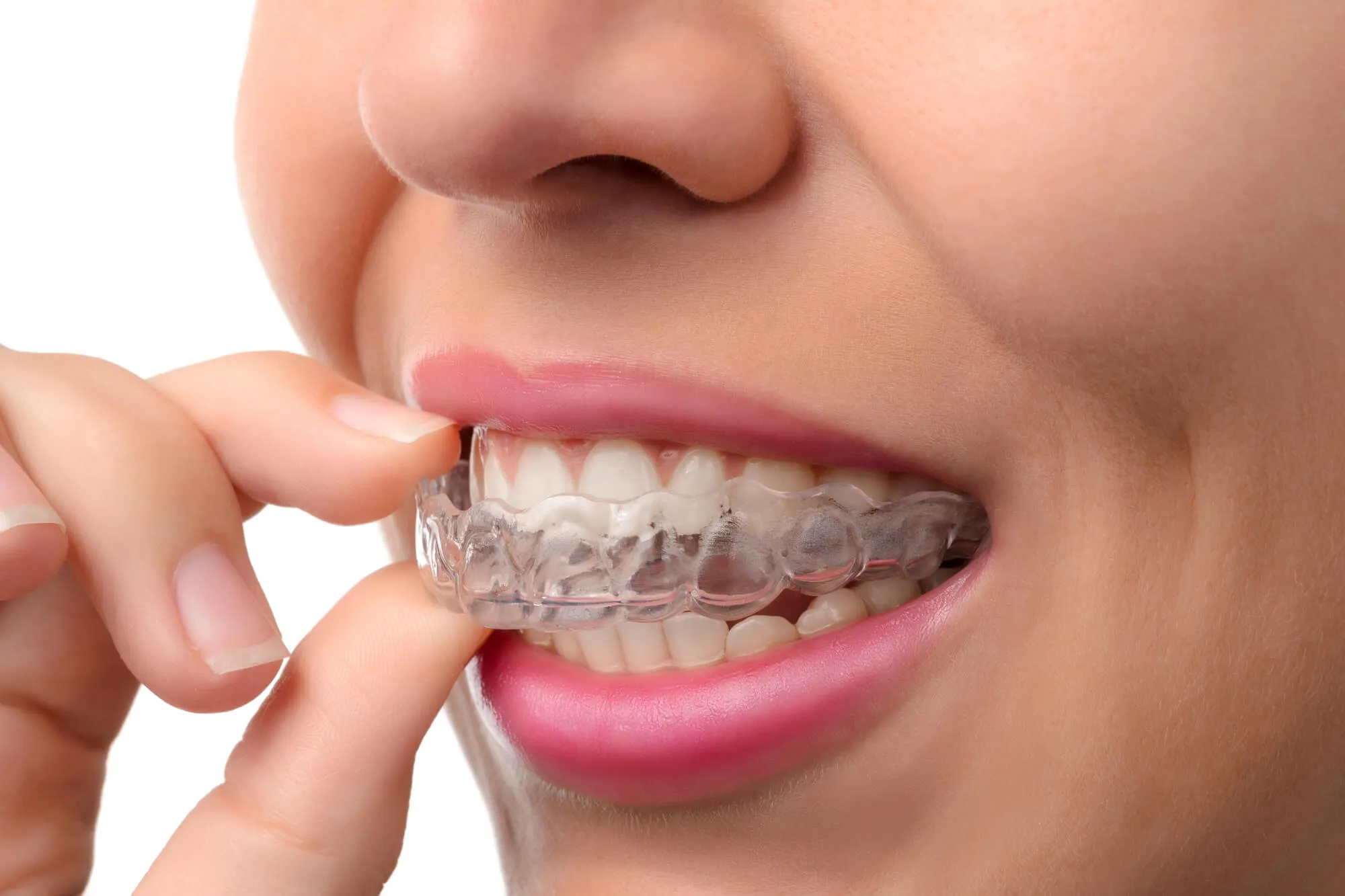 woman using invisalign in pottstown